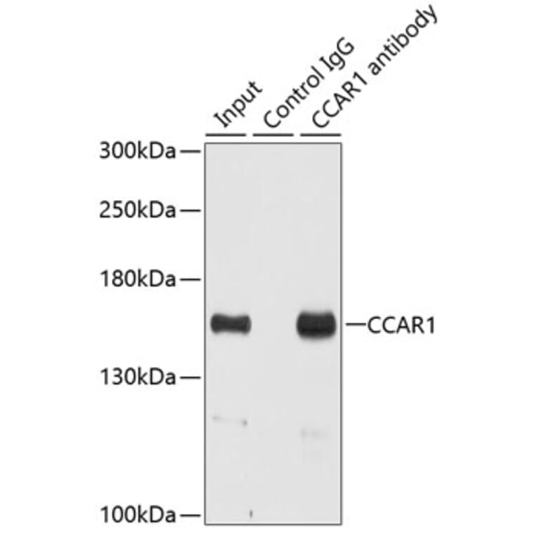 Western Blot - Anti-DIS Antibody (A15179) - Antibodies.com