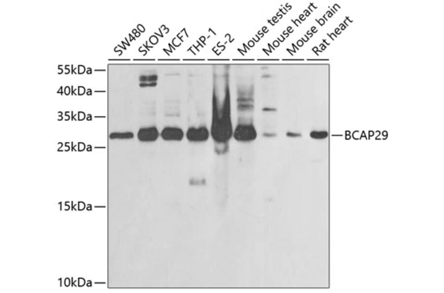 Western Blot - Anti-BAP29 Antibody (A15180) - Antibodies.com