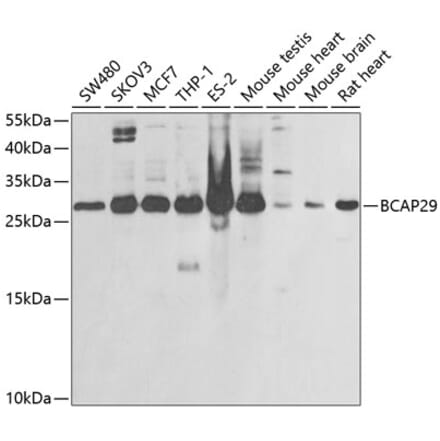 Western Blot - Anti-BAP29 Antibody (A15180) - Antibodies.com