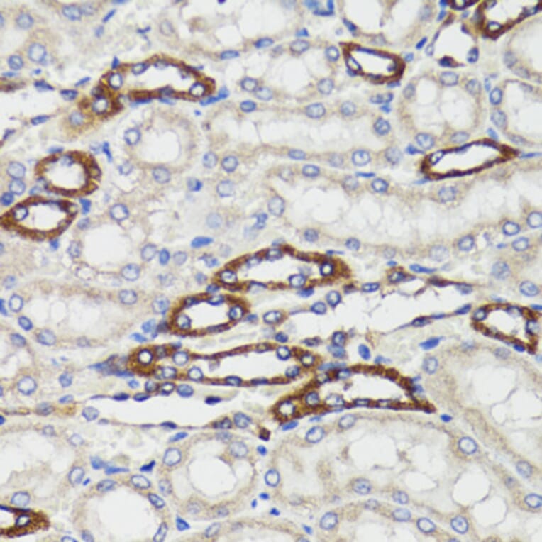 Immunohistochemistry - Anti-BAP29 Antibody (A15180) - Antibodies.com