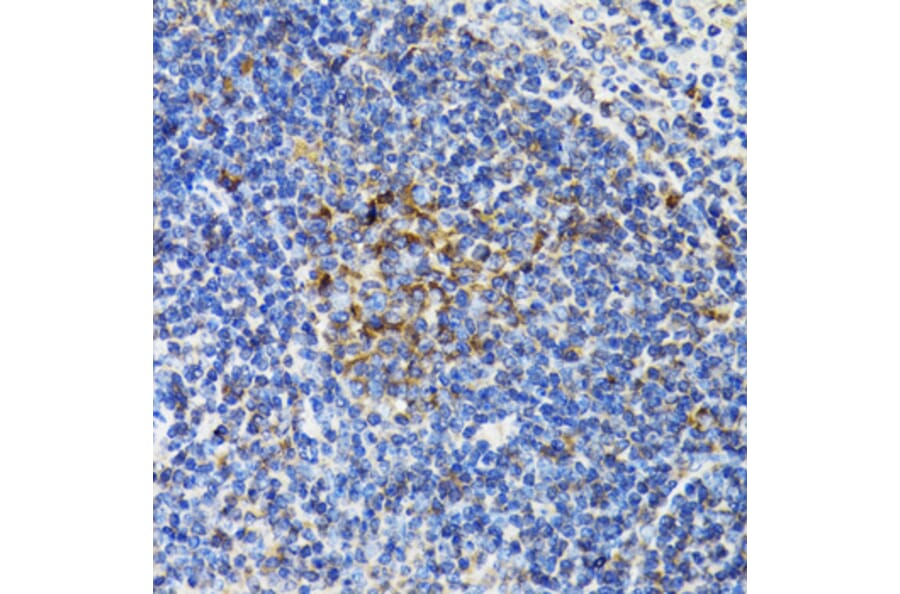 Immunohistochemistry - Anti-BAP29 Antibody (A15180) - Antibodies.com