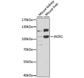 Western Blot - Anti-PHF17 Antibody (A15181) - Antibodies.com