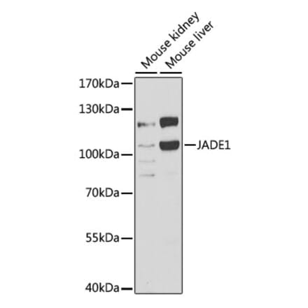 Western Blot - Anti-PHF17 Antibody (A15181) - Antibodies.com