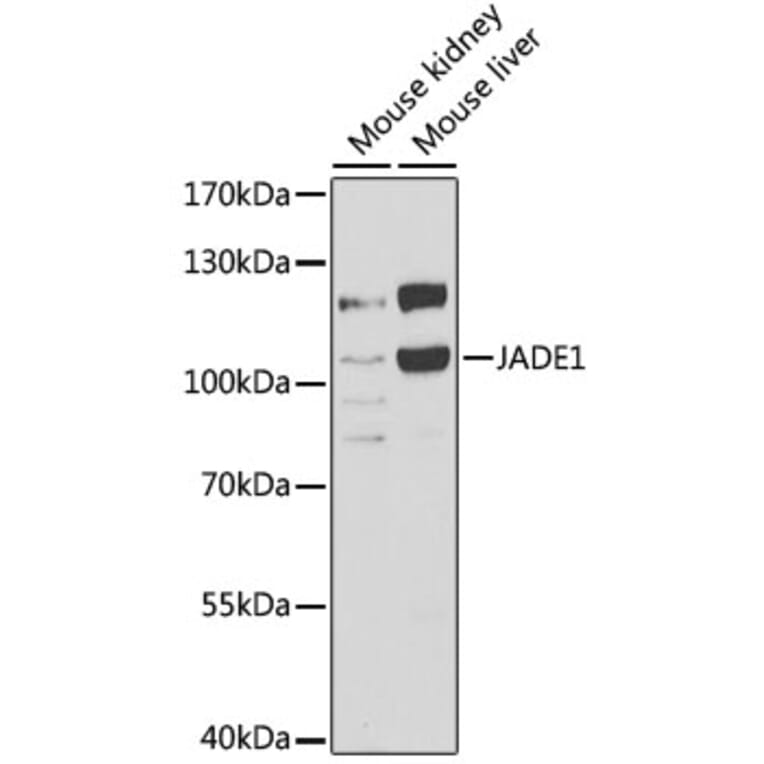 Western Blot - Anti-PHF17 Antibody (A15181) - Antibodies.com