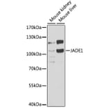 Western Blot - Anti-PHF17 Antibody (A15181) - Antibodies.com