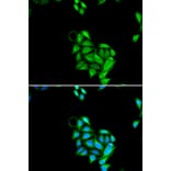 Immunofluorescence - Anti-PHF17 Antibody (A15181) - Antibodies.com