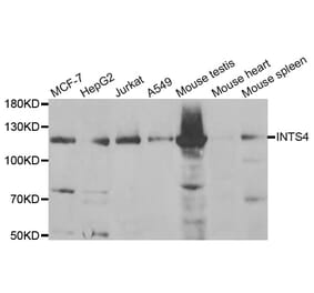 Western Blot - Anti-INTS4 Antibody (A6339) - Antibodies.com