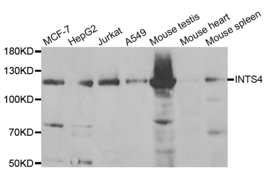 Western Blot - Anti-INTS4 Antibody (A6339) - Antibodies.com