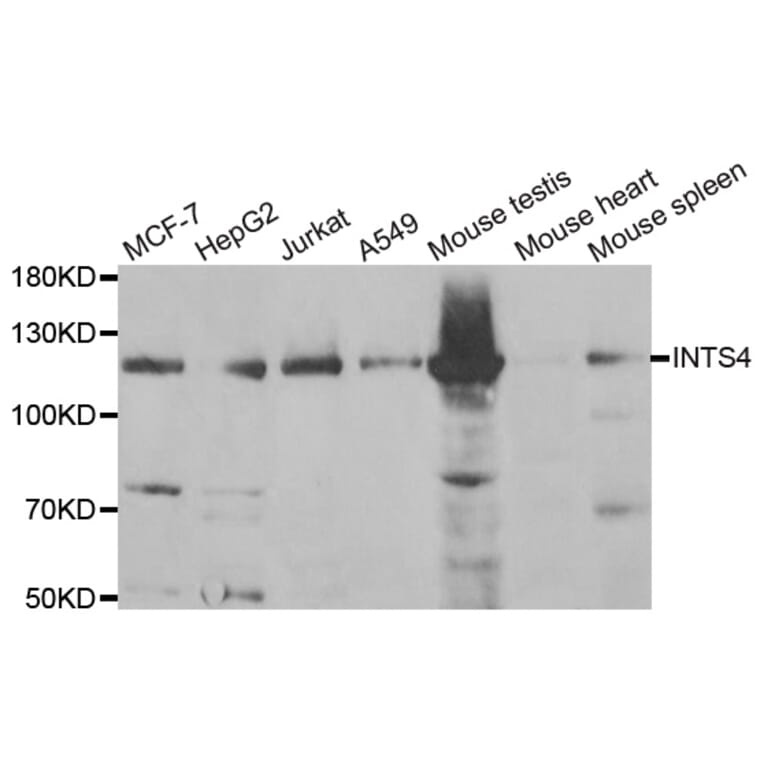 Western Blot - Anti-INTS4 Antibody (A6339) - Antibodies.com