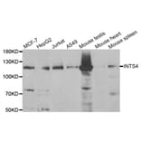 Western Blot - Anti-INTS4 Antibody (A6339) - Antibodies.com