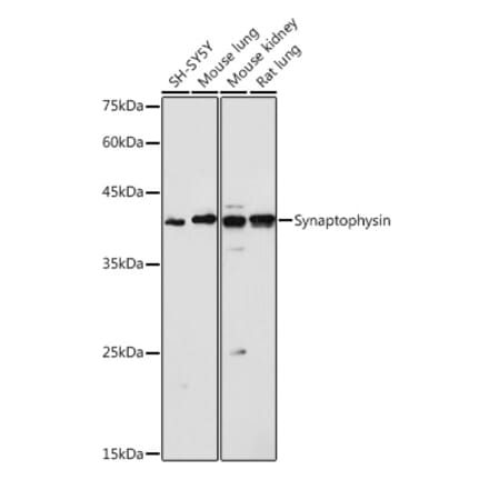 Western Blot - Anti-Synaptophysin Antibody (A15183) - Antibodies.com