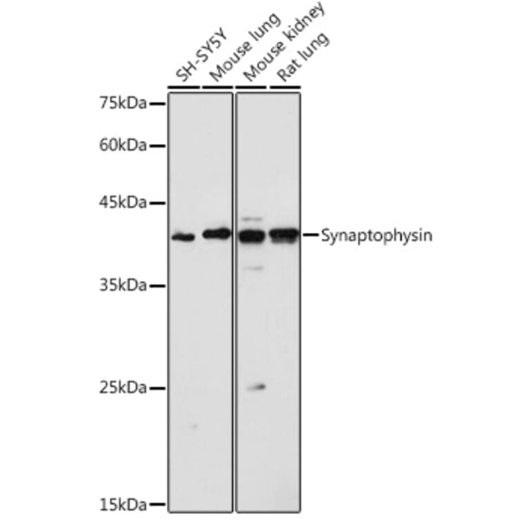 Western Blot - Anti-Synaptophysin Antibody (A15183) - Antibodies.com