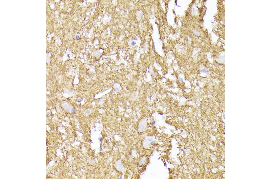 Immunohistochemistry - Anti-Synaptophysin Antibody (A15183) - Antibodies.com