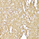 Immunohistochemistry - Anti-Synaptophysin Antibody (A15183) - Antibodies.com