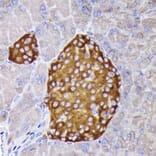 Immunohistochemistry - Anti-Synaptophysin Antibody (A15183) - Antibodies.com