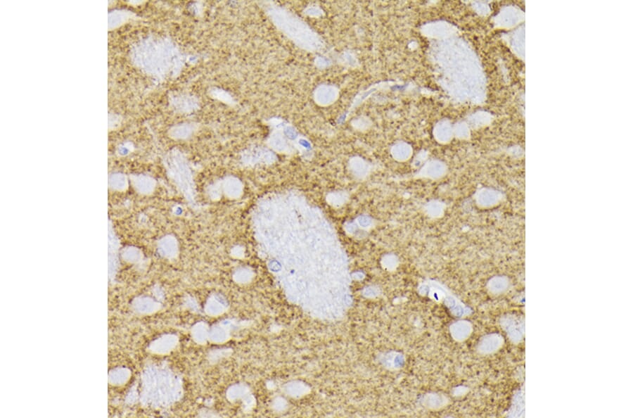 Immunohistochemistry - Anti-Synaptophysin Antibody (A15183) - Antibodies.com