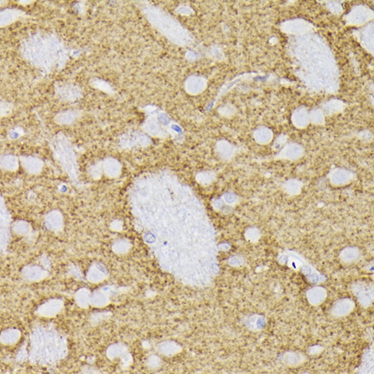 Immunohistochemistry - Anti-Synaptophysin Antibody (A15183) - Antibodies.com