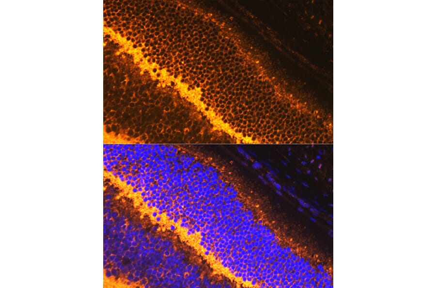 IHC of mouse retina using anti-Synaptophysin Antibody (A15183)