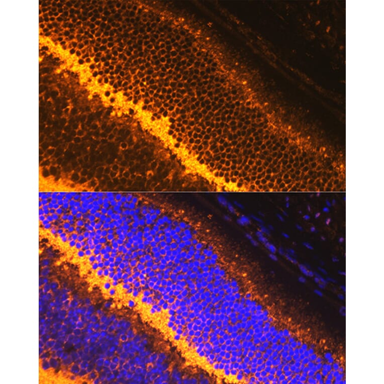 Immunofluorescence - Anti-Synaptophysin Antibody (A15183) - Antibodies.com