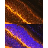 Immunofluorescence - Anti-Synaptophysin Antibody (A15183) - Antibodies.com