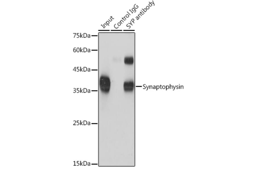 Western Blot - Anti-Synaptophysin Antibody (A15183) - Antibodies.com
