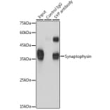 Western Blot - Anti-Synaptophysin Antibody (A15183) - Antibodies.com