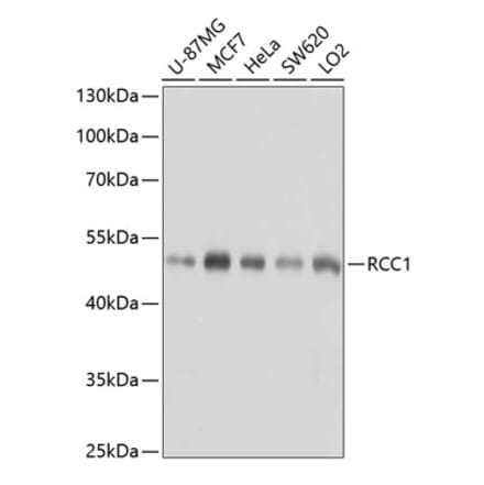 Western Blot - Anti-RCC1 Antibody (A15185) - Antibodies.com