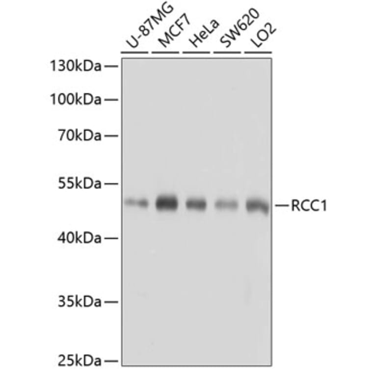 Western Blot - Anti-RCC1 Antibody (A15185) - Antibodies.com