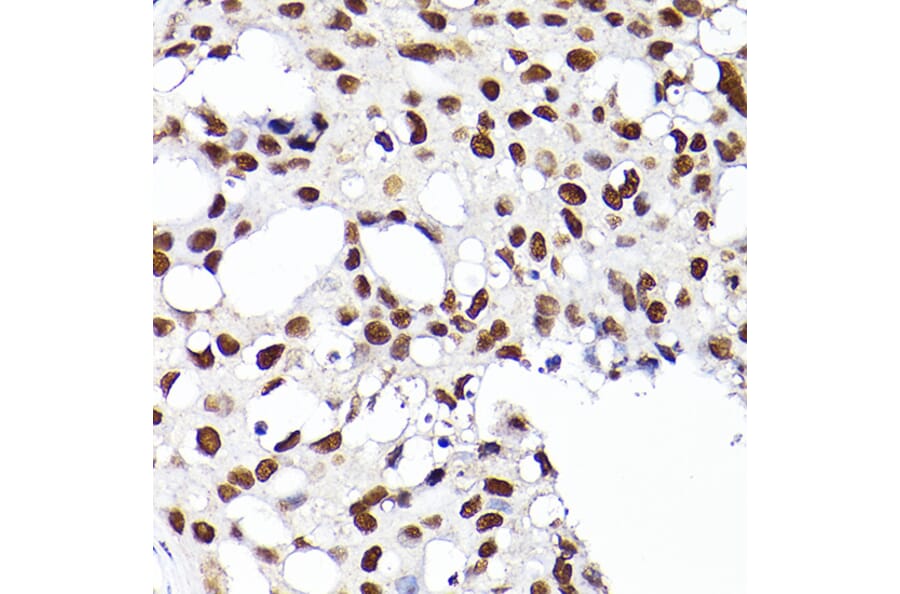 Immunohistochemistry - Anti-RCC1 Antibody (A15185) - Antibodies.com