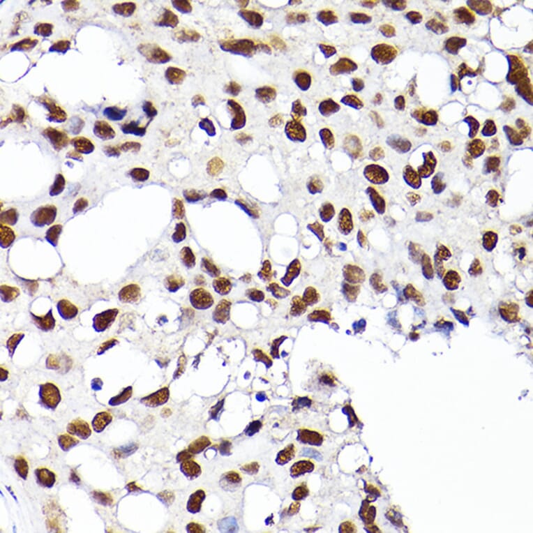 Immunohistochemistry - Anti-RCC1 Antibody (A15185) - Antibodies.com