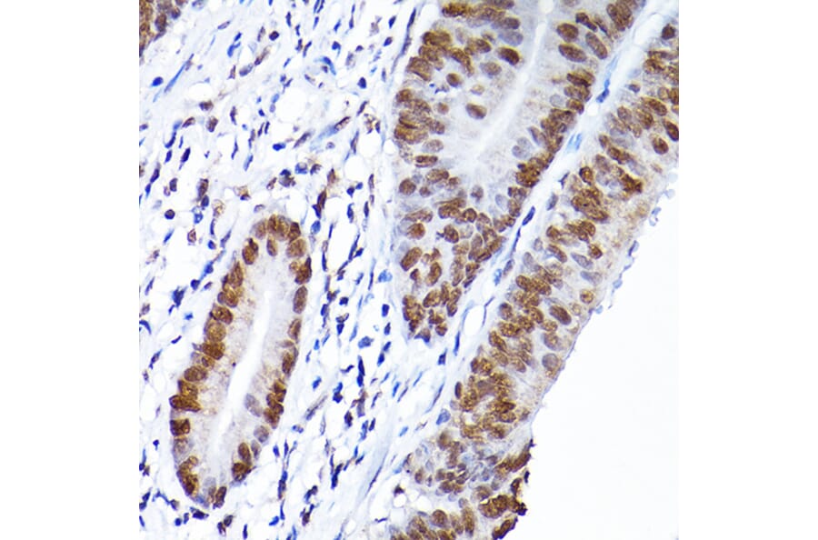 Immunohistochemistry - Anti-RCC1 Antibody (A15185) - Antibodies.com