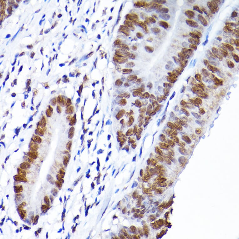 Immunohistochemistry - Anti-RCC1 Antibody (A15185) - Antibodies.com