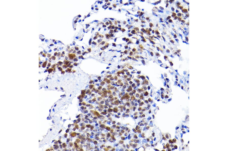 Immunohistochemistry - Anti-RCC1 Antibody (A15185) - Antibodies.com