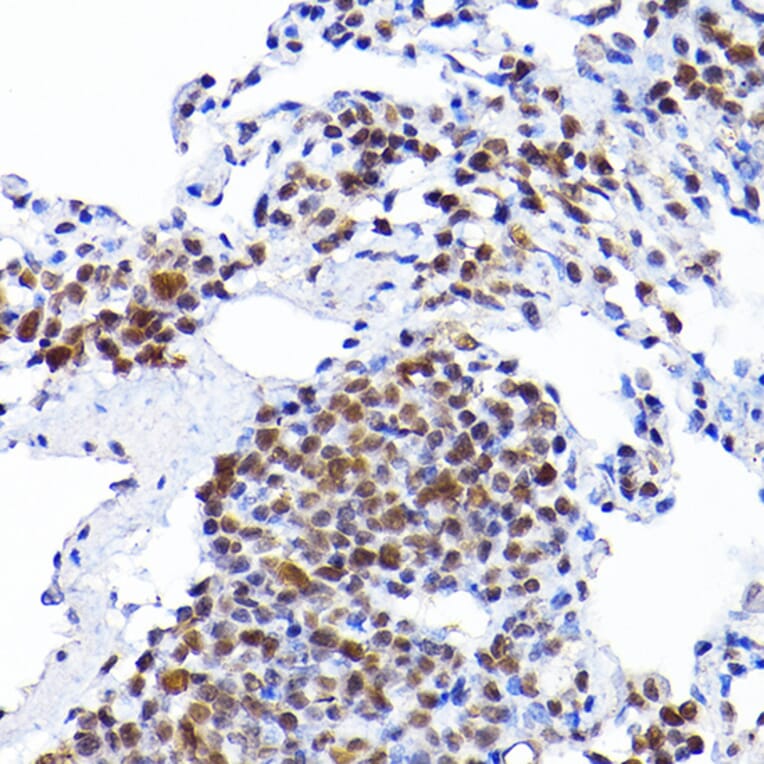 Immunohistochemistry - Anti-RCC1 Antibody (A15185) - Antibodies.com