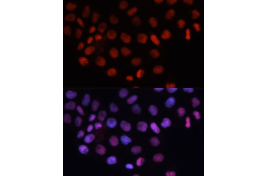 Immunofluorescence - Anti-RCC1 Antibody (A15185) - Antibodies.com