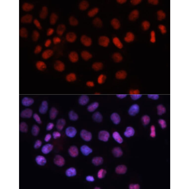 Immunofluorescence - Anti-RCC1 Antibody (A15185) - Antibodies.com