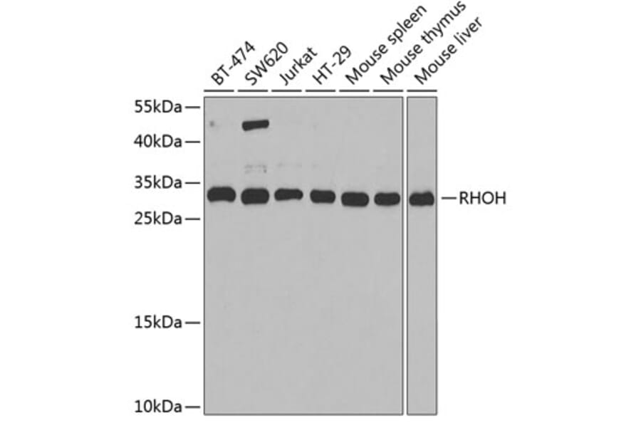 Western Blot - Anti-RHOH Antibody (A15186) - Antibodies.com