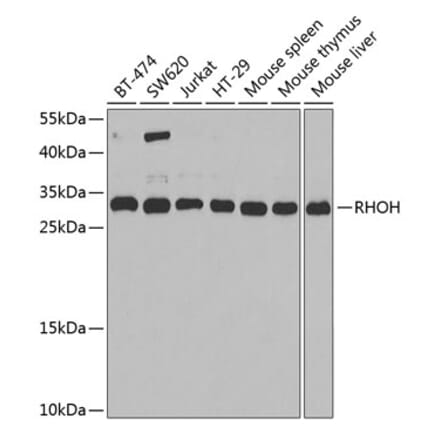 Western Blot - Anti-RHOH Antibody (A15186) - Antibodies.com