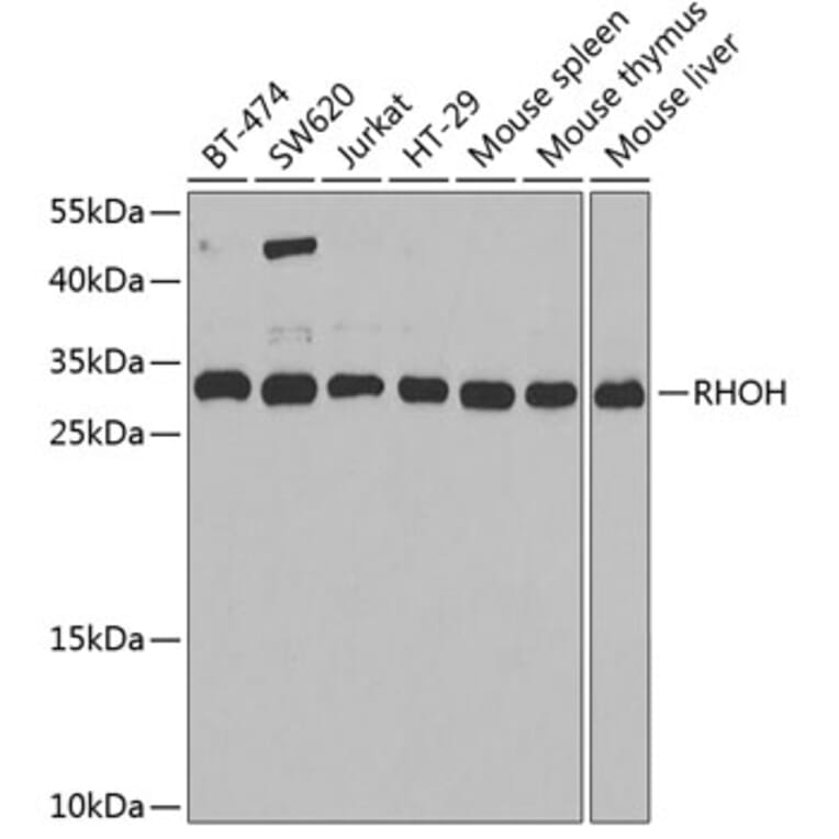 Western Blot - Anti-RHOH Antibody (A15186) - Antibodies.com