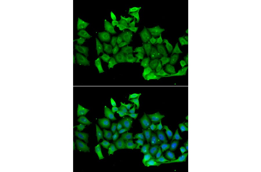 Immunofluorescence - Anti-RHOH Antibody (A15186) - Antibodies.com