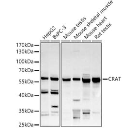 Western Blot - Anti-CRAT Antibody (A15188) - Antibodies.com