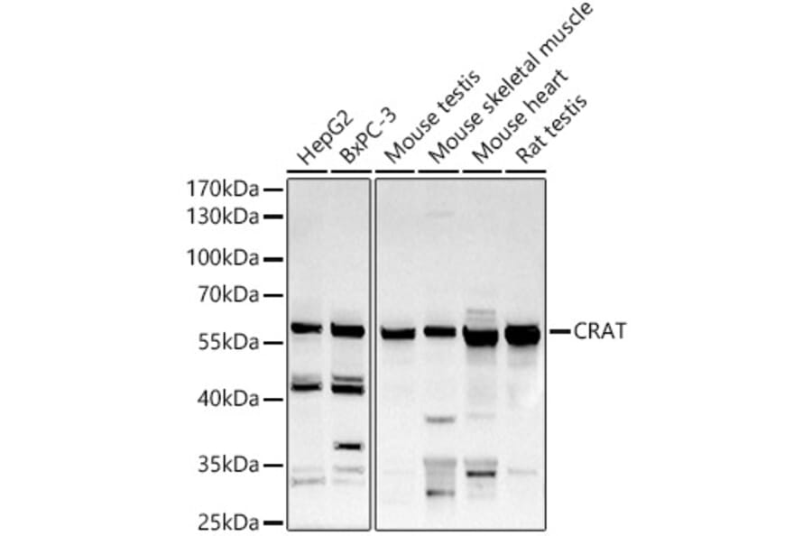 Western Blot - Anti-CRAT Antibody (A15188) - Antibodies.com