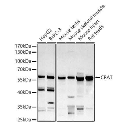 Western Blot - Anti-CRAT Antibody (A15188) - Antibodies.com