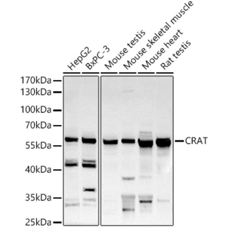 Western Blot - Anti-CRAT Antibody (A15188) - Antibodies.com