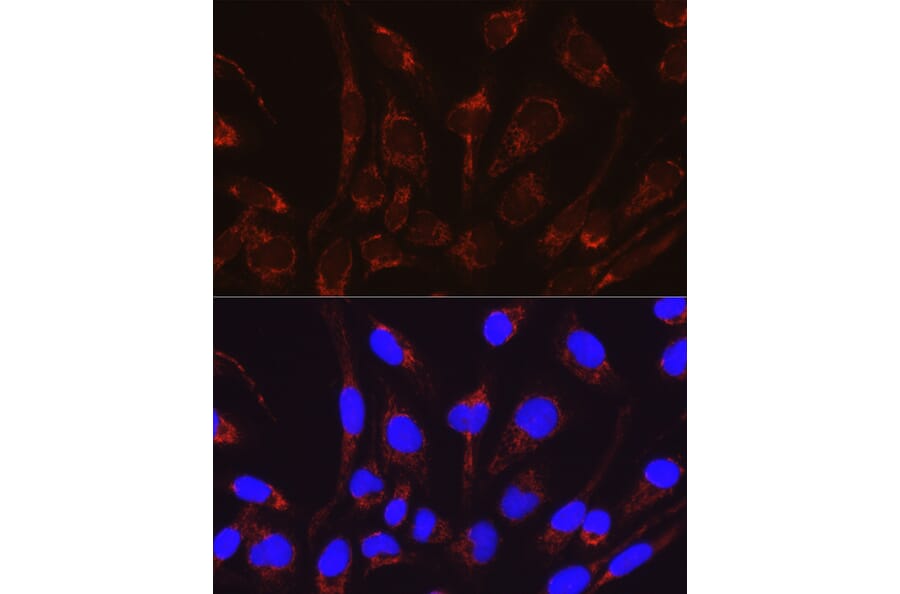 Immunofluorescence - Anti-CRAT Antibody (A15188) - Antibodies.com