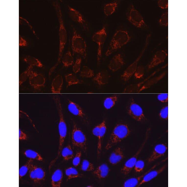 Immunofluorescence - Anti-CRAT Antibody (A15188) - Antibodies.com