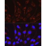 Immunofluorescence - Anti-CRAT Antibody (A15188) - Antibodies.com