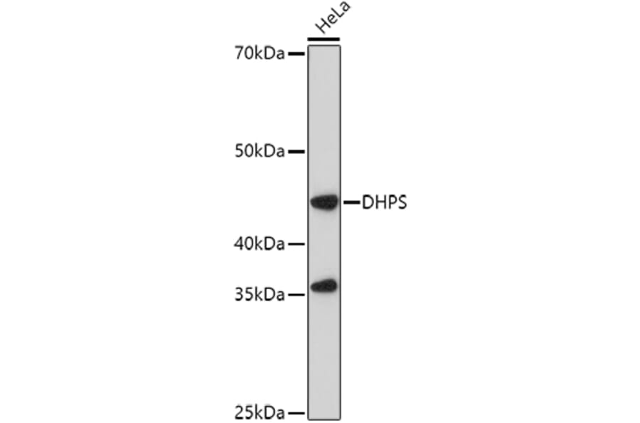 Western Blot - Anti-DHPS/DHS Antibody (A15189) - Antibodies.com