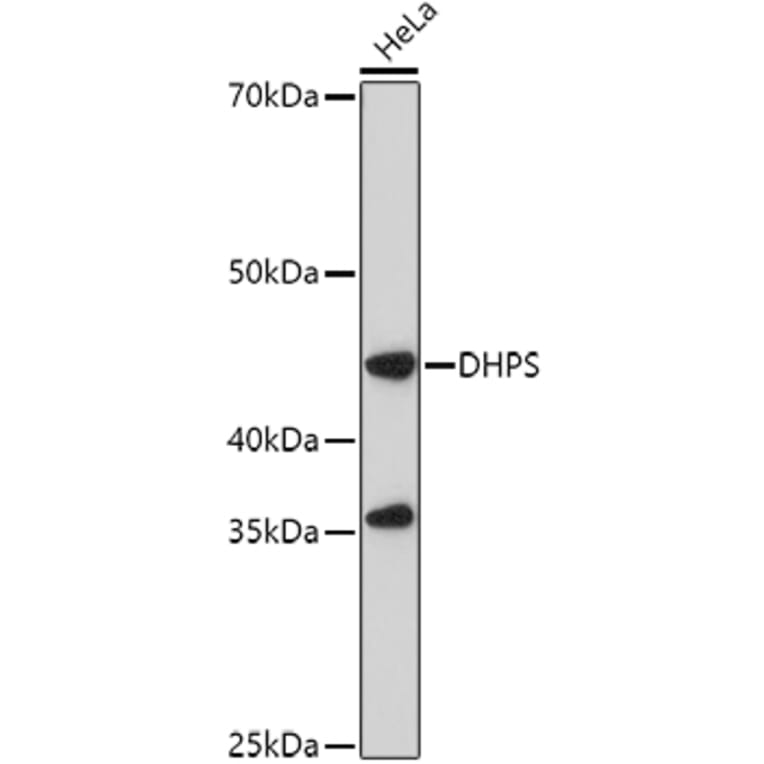 Western Blot - Anti-DHPS/DHS Antibody (A15189) - Antibodies.com