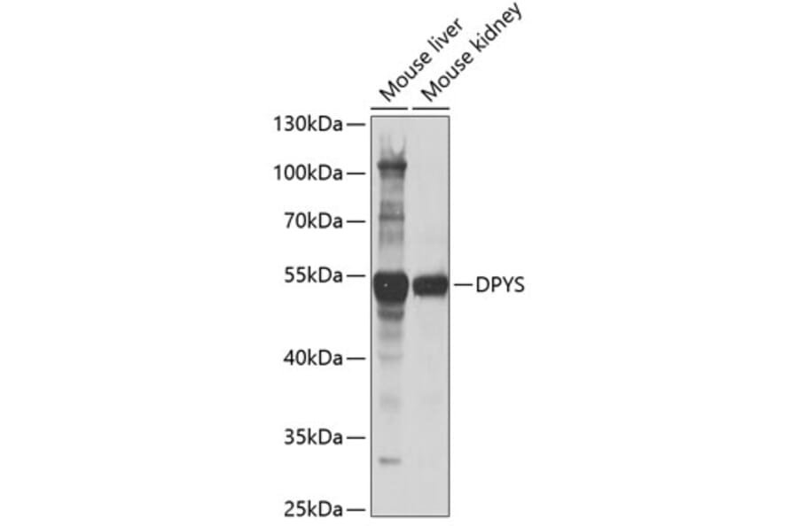 Western Blot - Anti-DPYS Antibody (A15190) - Antibodies.com